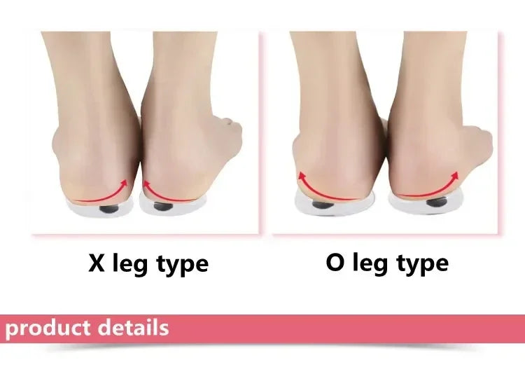 Orthopedic Silicone Gel Insoles, O/X Leg Correction, Magnet Massage, 1 Pair